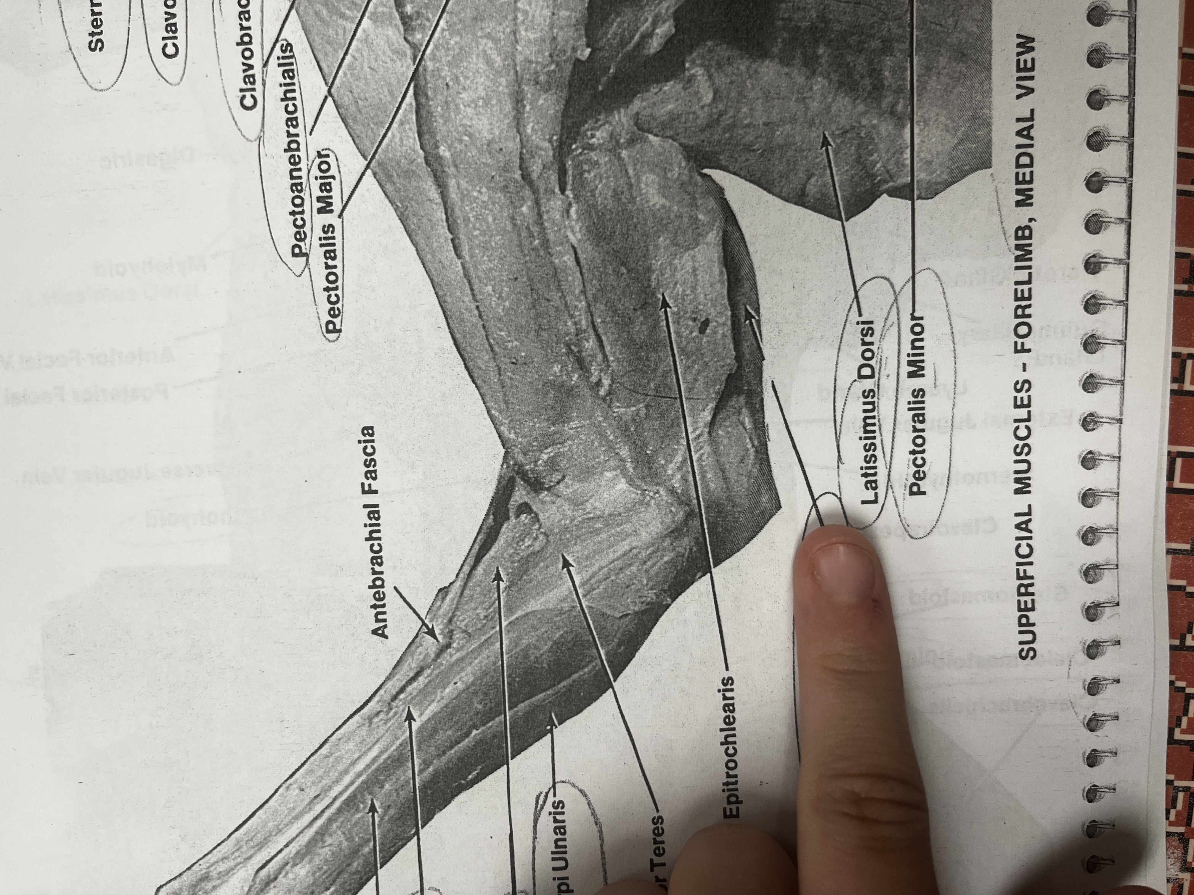 <p>A muscle in the upper arm that extends the elbow.</p>
