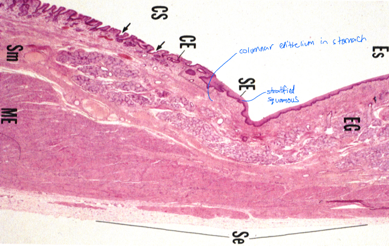 <ul><li><p>drastic change from stratified squamous in esophagus to simple columnar in stomach </p><ul><li><p>withstands acidity  </p></li></ul></li><li><p>seromucous glands into stomach for short distance, then disappear </p></li></ul>