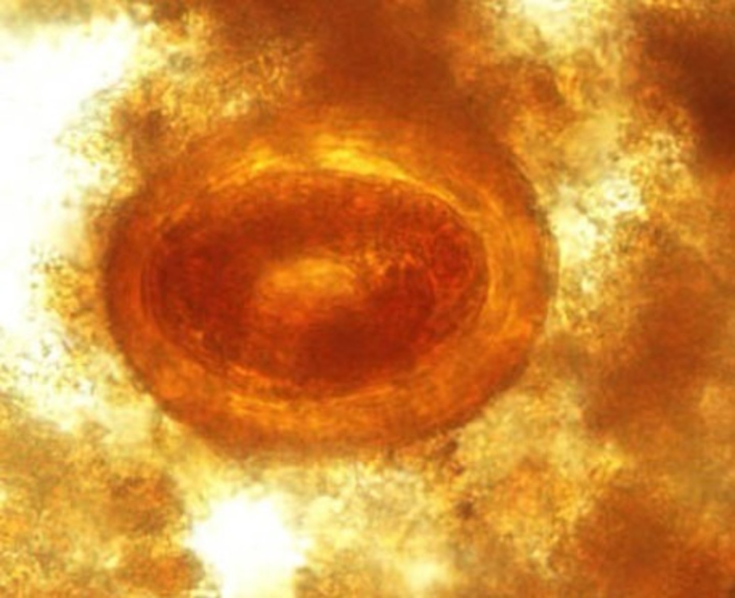 <p>Identify the parasite</p>