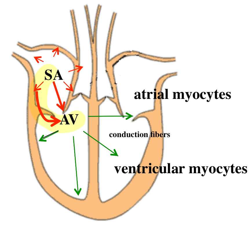 <p>additional pathway to AV node —&gt; send 2 pulses instead of 1 to the rest of the heart</p><ul><li><p>the normal AV node pathway, consist of slow-response tissue</p></li><li><p>the accessory pathway, consist of fast-response tissue</p></li></ul><p></p>