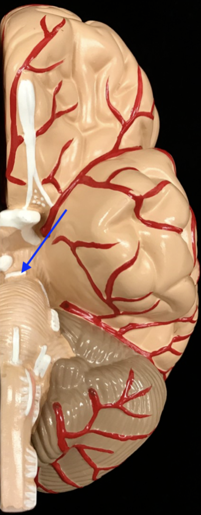 <p>What is the cranial nerve and roman numeral?</p>