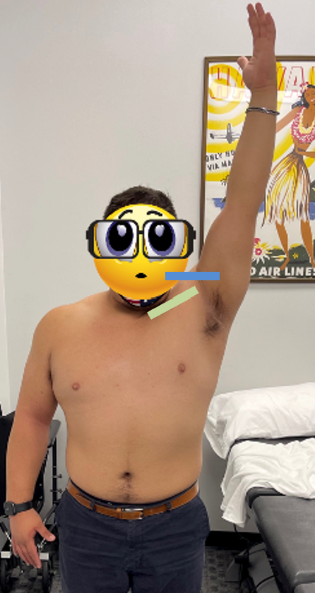 <p>Posterior retraction and spin</p>