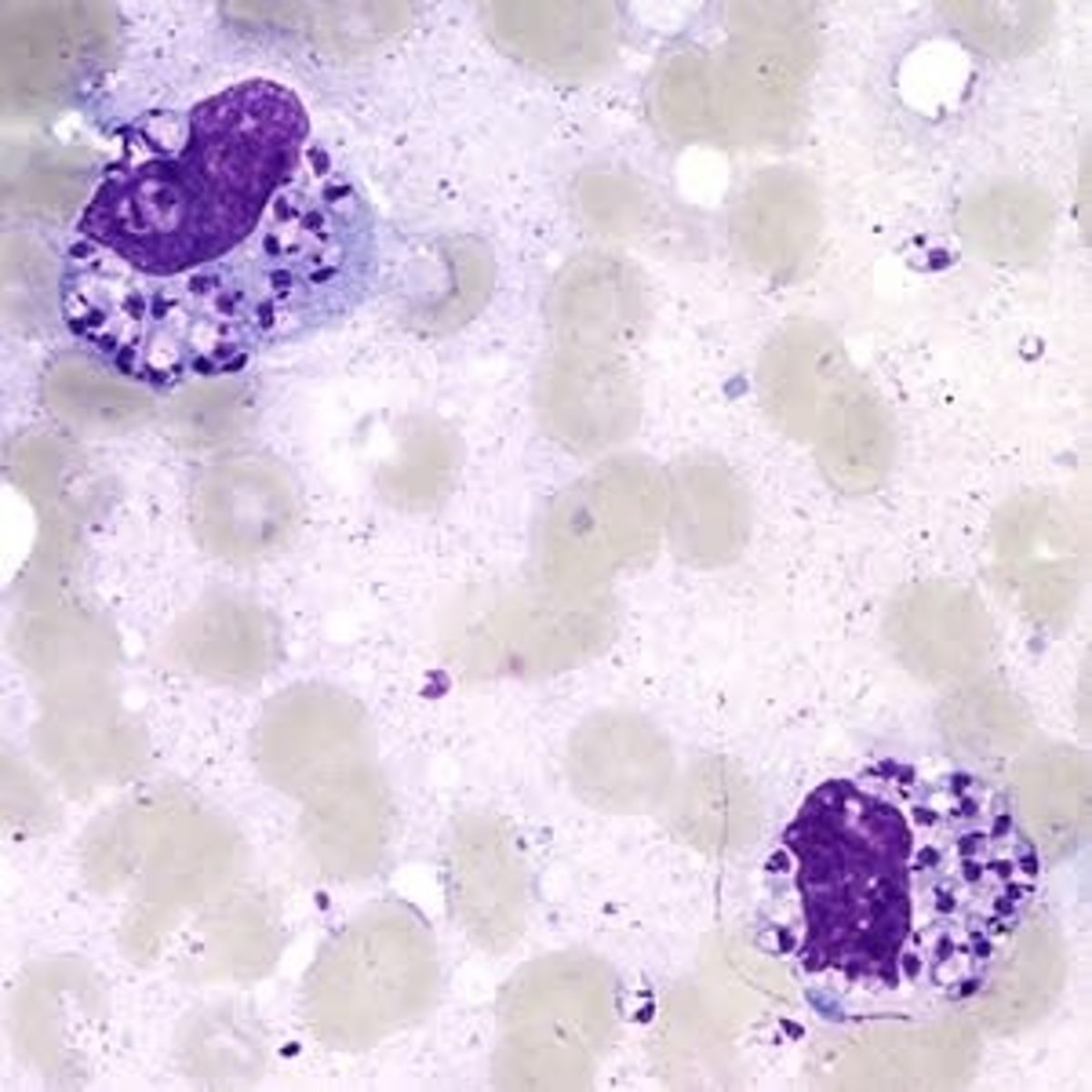 <p>-amastigote: non-motile stage</p><p>-amistigote found in macrophages!</p><p>-SAND FLIES!</p><p>-mostly South America!</p><p>-promastigote: motile stage in blood (not as often seen i guess)</p><p>VISCERAL:</p><p>-fever, panctopenia, hepatosplenomegaly</p><p>-fatal if not treated with antimony (also toxic)</p><p>CUTANEOUS:</p><p>-lesions</p><p>MUCOCUTANEOUS:</p><p>-in the nose or mouth</p>