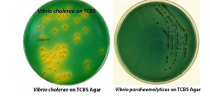 <p>Based on the picture describe the hemolytic pattern of the ff Vibrio spp.</p>