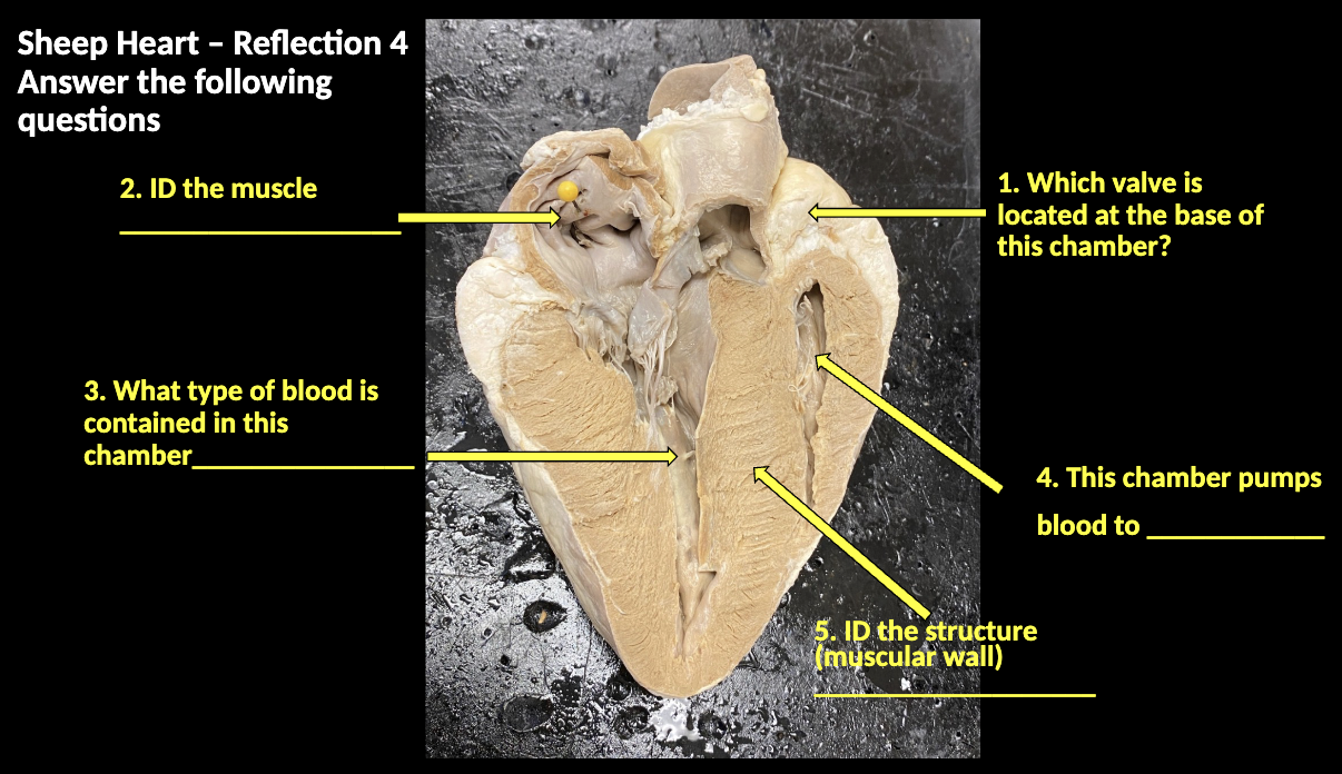 <p>1) bicuspid/ mitral valve<br>2) pectinate muscle<br>3) deoxygenated blood <br>4) left ventricle<br>5) interventricular septum</p>