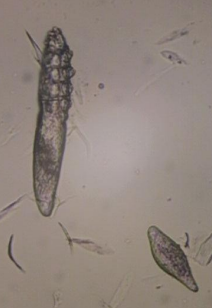 <p><span>Skin Scraping for Dermatology</span></p>