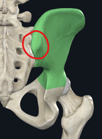 <p>What is this called?</p>