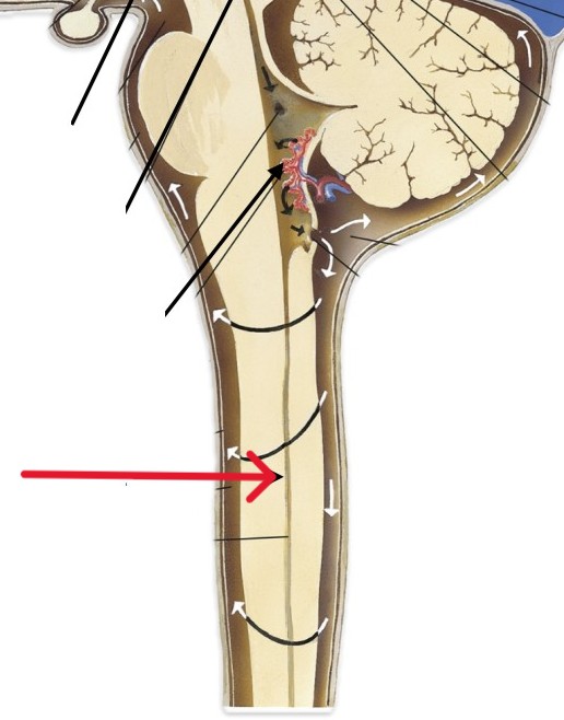 <p>Which part of the brain is:</p><ul><li><p>Lower tip of fourth ventricle</p></li><li><p>Upper brainstem</p></li></ul><p></p>