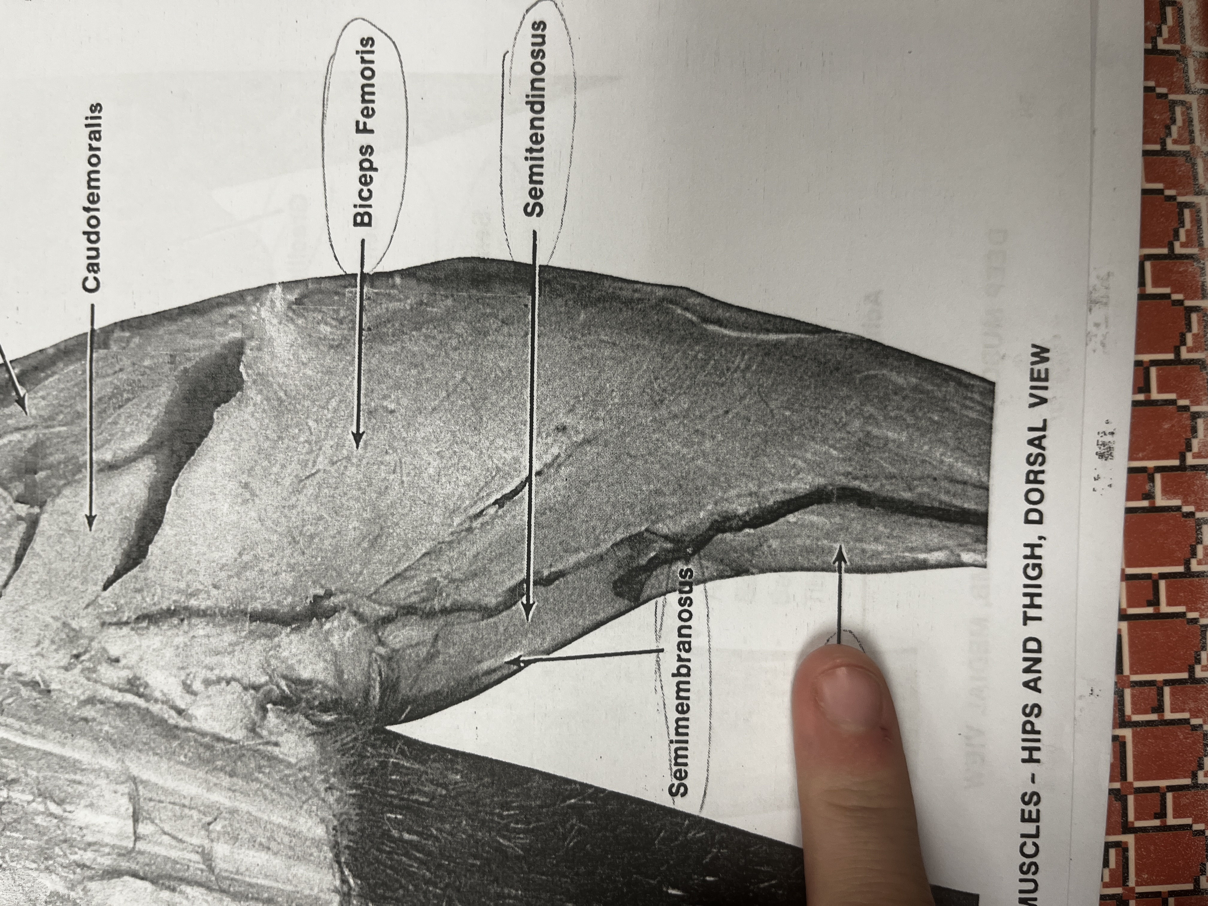 <p>A major muscle in the calf that helps flex the knee and plantarflex the foot.</p>