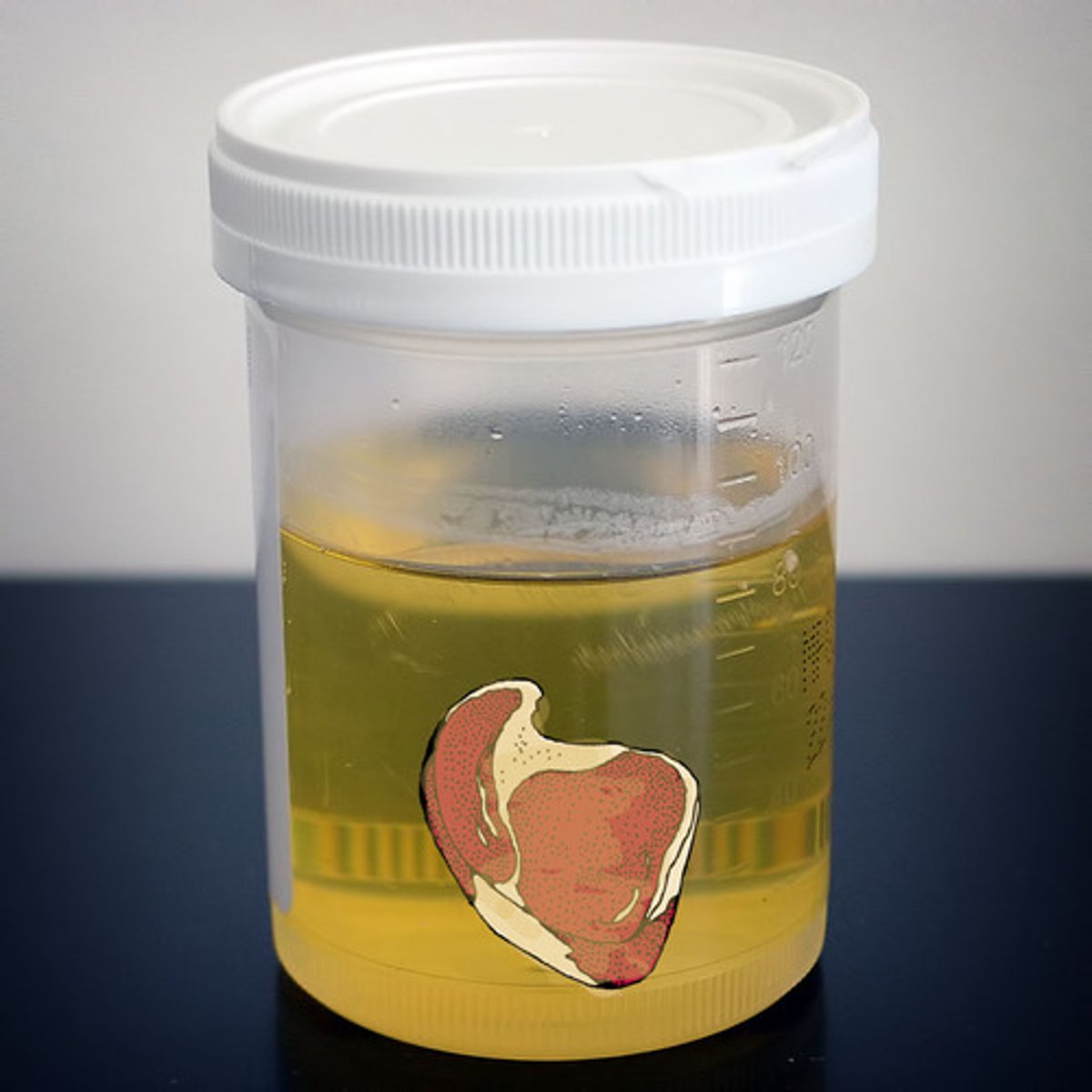 <p>protein in your pee </p>