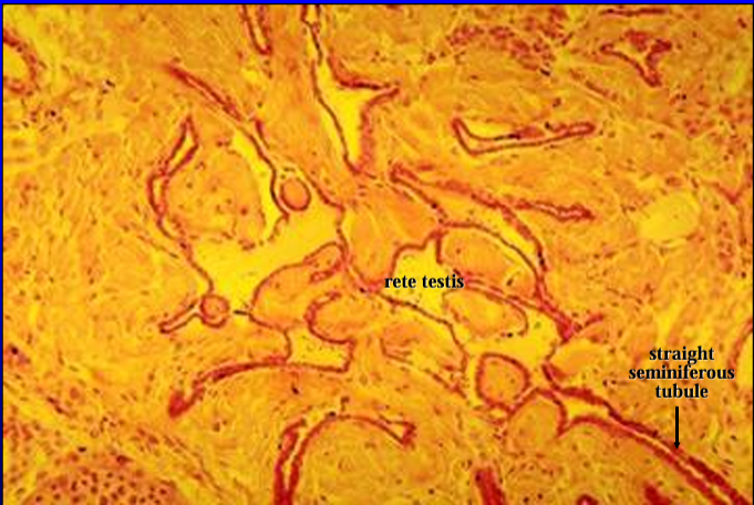 <p>Rete testis. </p><p>Both straight seminiferous tubules and rete testis are l<strong>ined by a simple low cuboidal epithelium</strong></p>