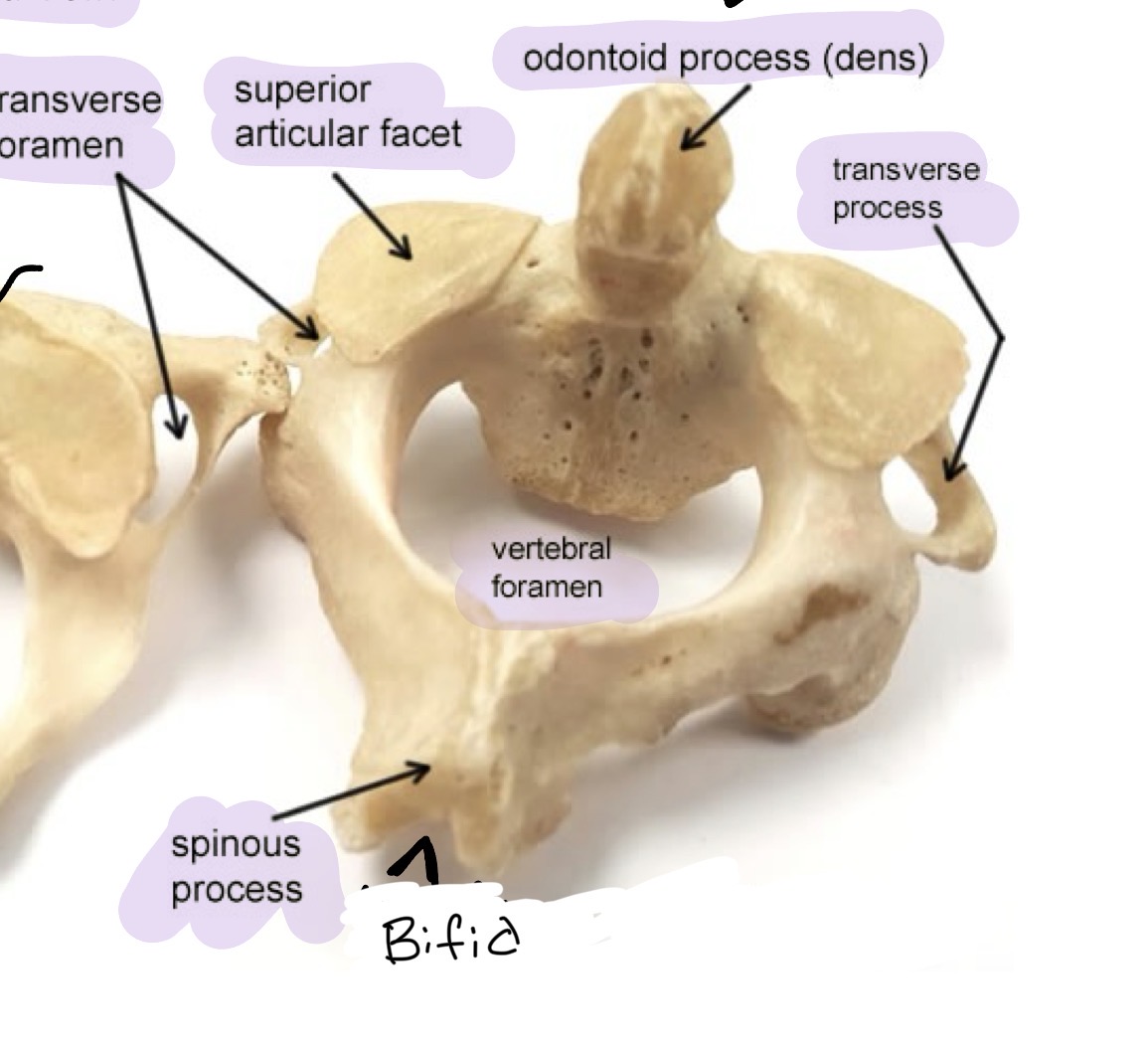 <p>Has odontoid process (dens) and spinous process   </p>