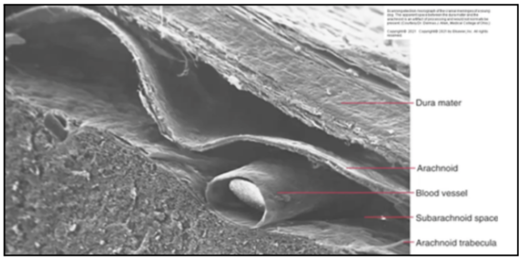 <p>SUBARACHNOID SPACE</p>