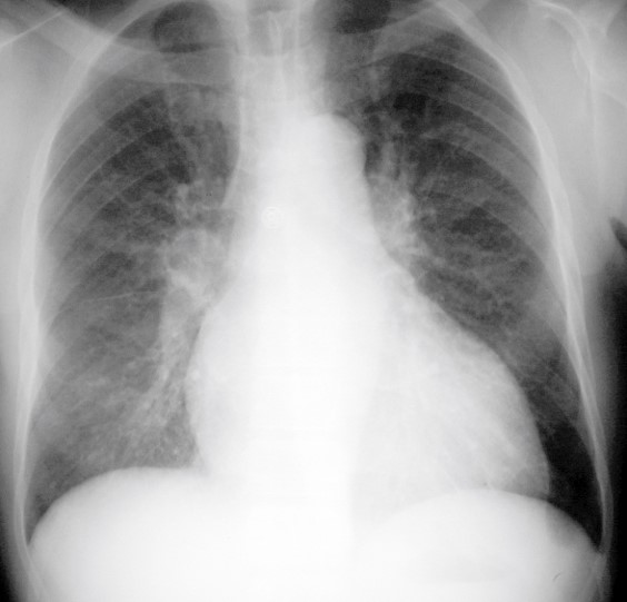 <p>Describe the abnormality demonstrated.</p>