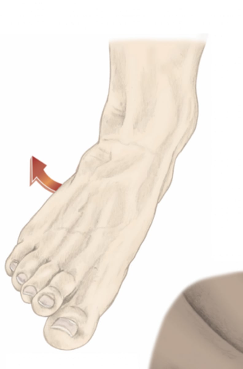 <p>please identify the movement and its location</p>