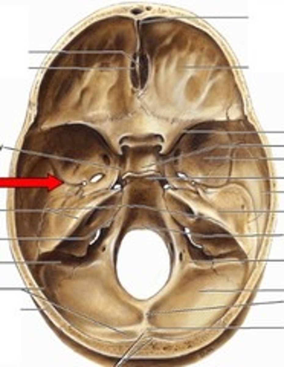 knowt flashcard image