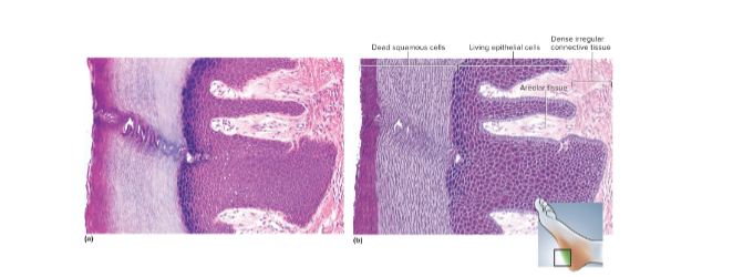 <p>Keratinized stratified squamous epithelium</p>