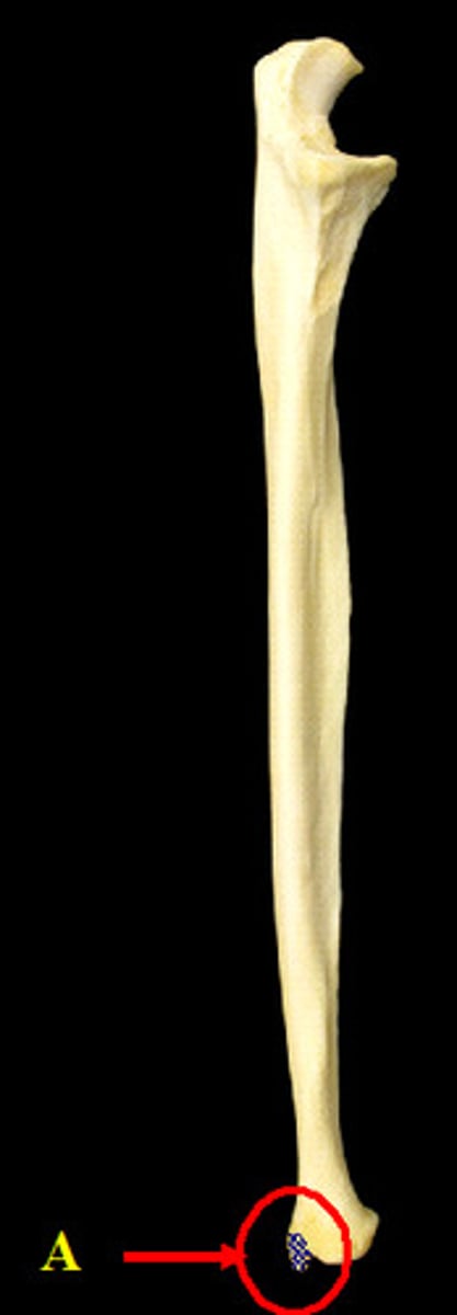 <p>Name the structure.</p>
