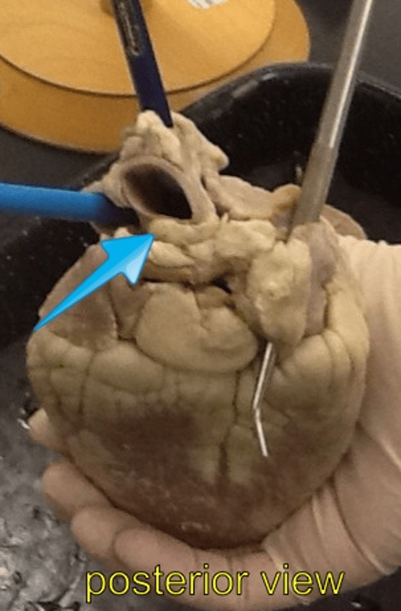 <p>Identify what BLUE arrow is pointing to:</p>