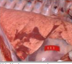 <p>Margin of the lesion</p>