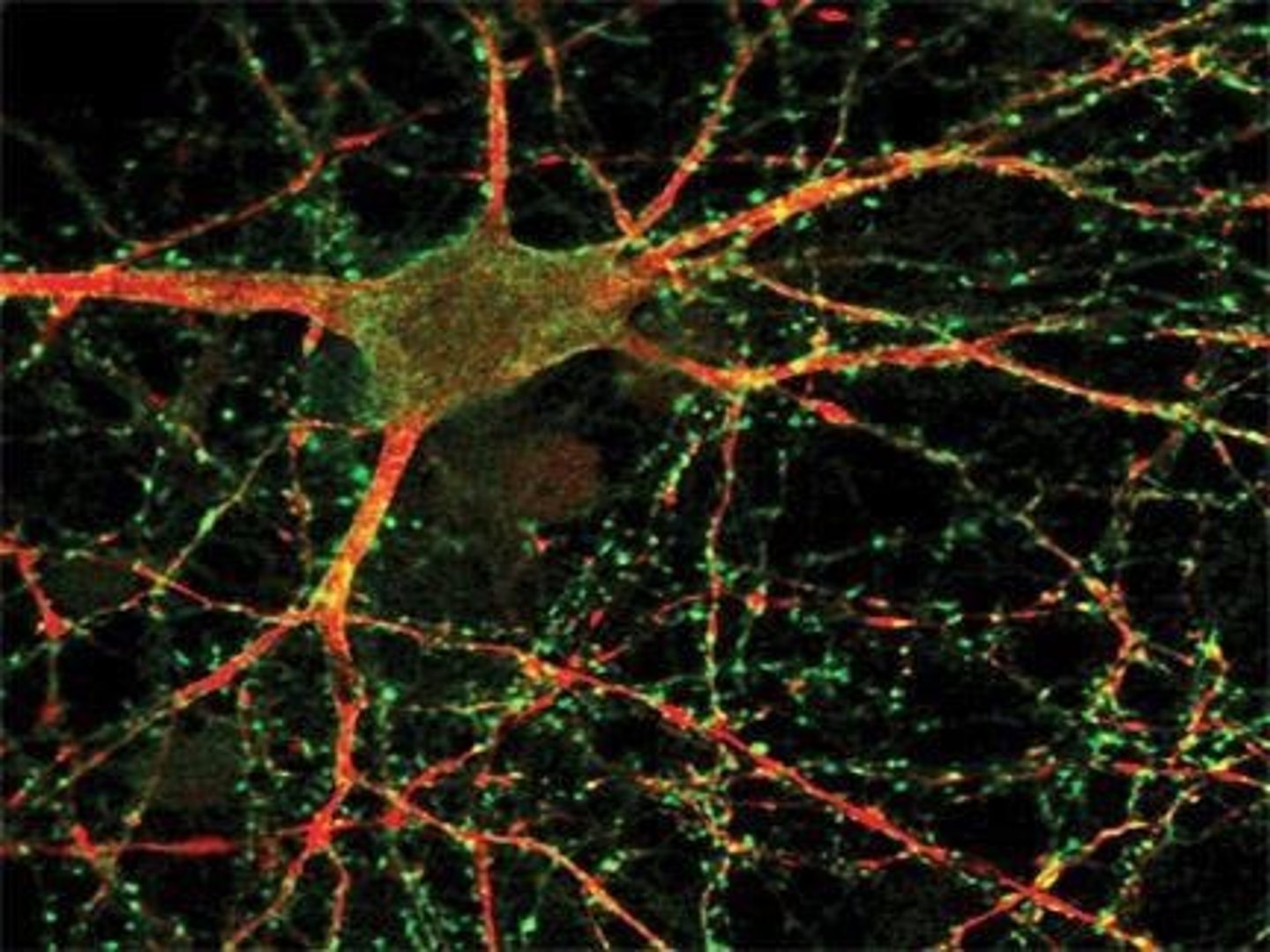 <p>Technique measuring activity of individual neurons.</p>