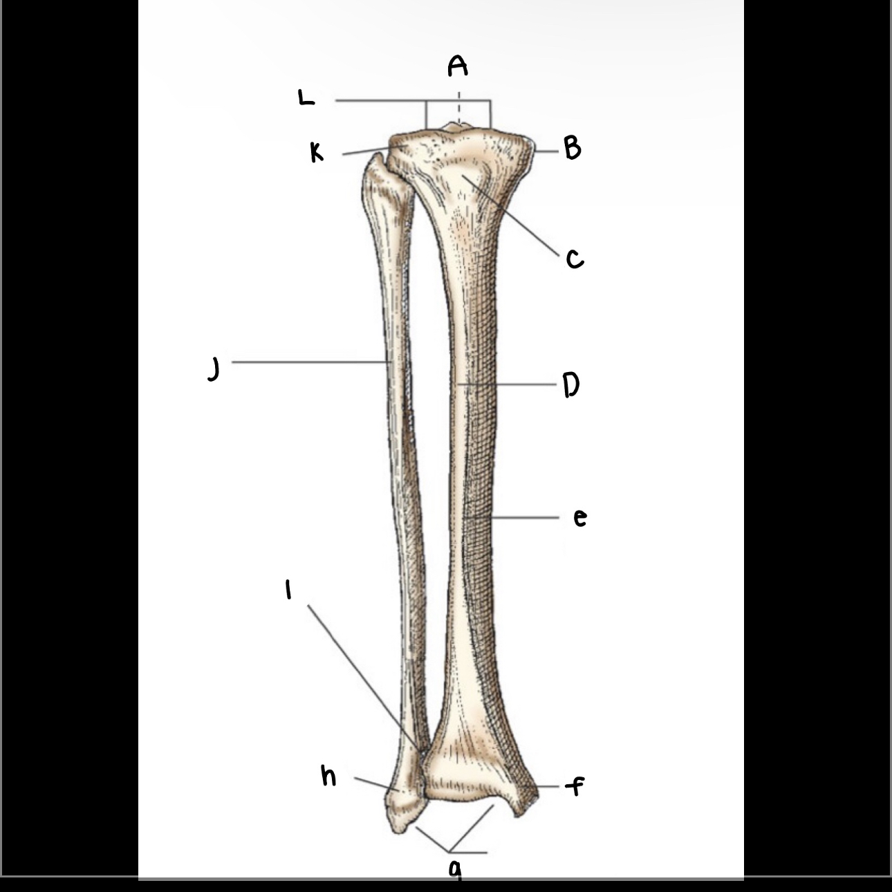 <p>What is letter C pointing to?</p>