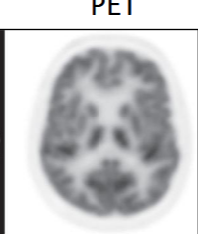 <ul><li><p>capability to accurately depict two distinct events in space/time/frequency as separate corresponding to the spatial/temporal/spectral resolution</p></li><li><p>PET has high contrast and poor spatial resolution</p></li><li><p>can be quantified by the period of sinusoidal input. resolution = period of sine at 1/uc</p></li></ul><p></p>