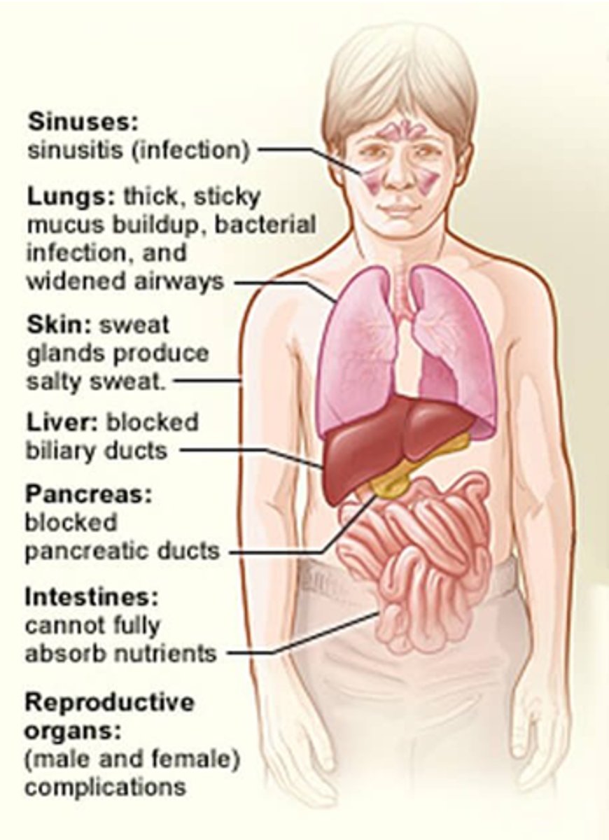 <p>Thick, sticky mucus build up, bacterial infections and widened airways.</p>