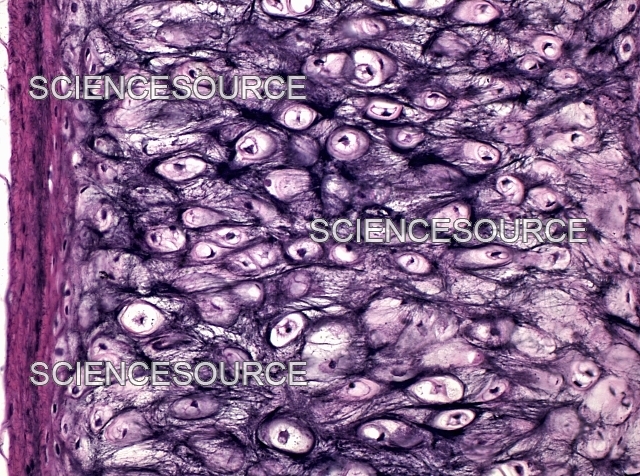 <p><strong>What is a picture example of elastic cartilage tissue?</strong></p>