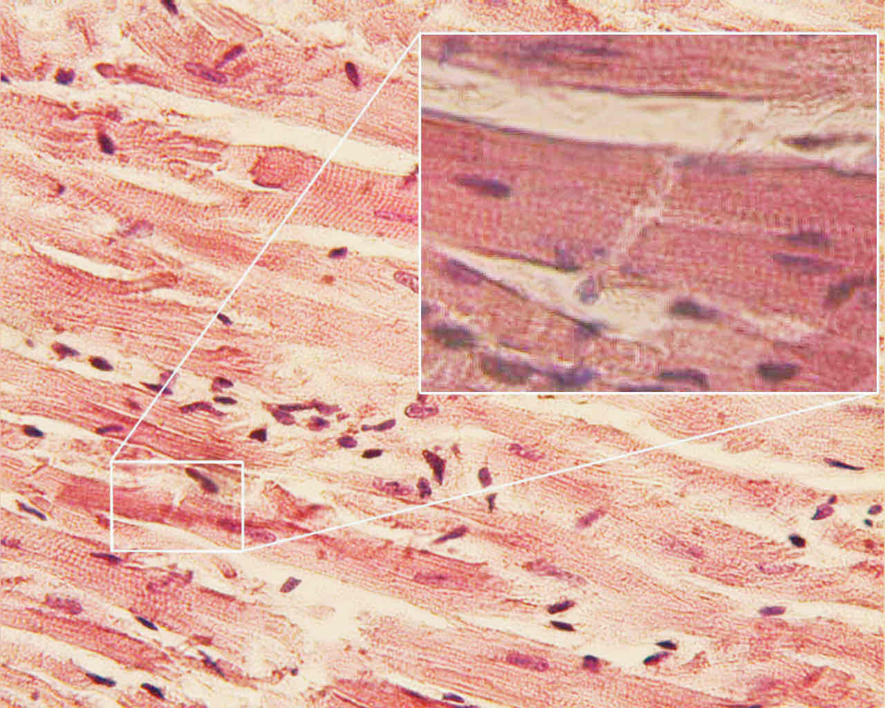 <p>Specialized connections between cardiac muscle cells that facilitate synchronized contraction.</p>