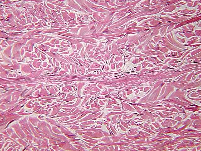 <p>what kind of tissue is this (type and subtype)</p>