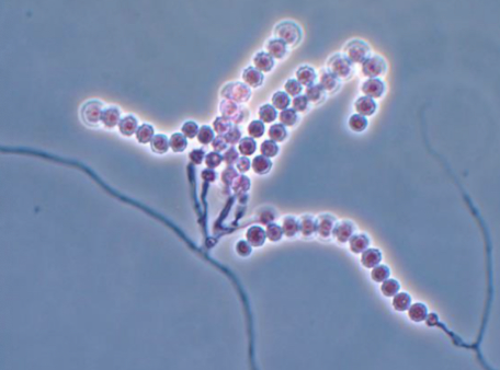 <p>Scopulariopsis Brevicaulis</p>