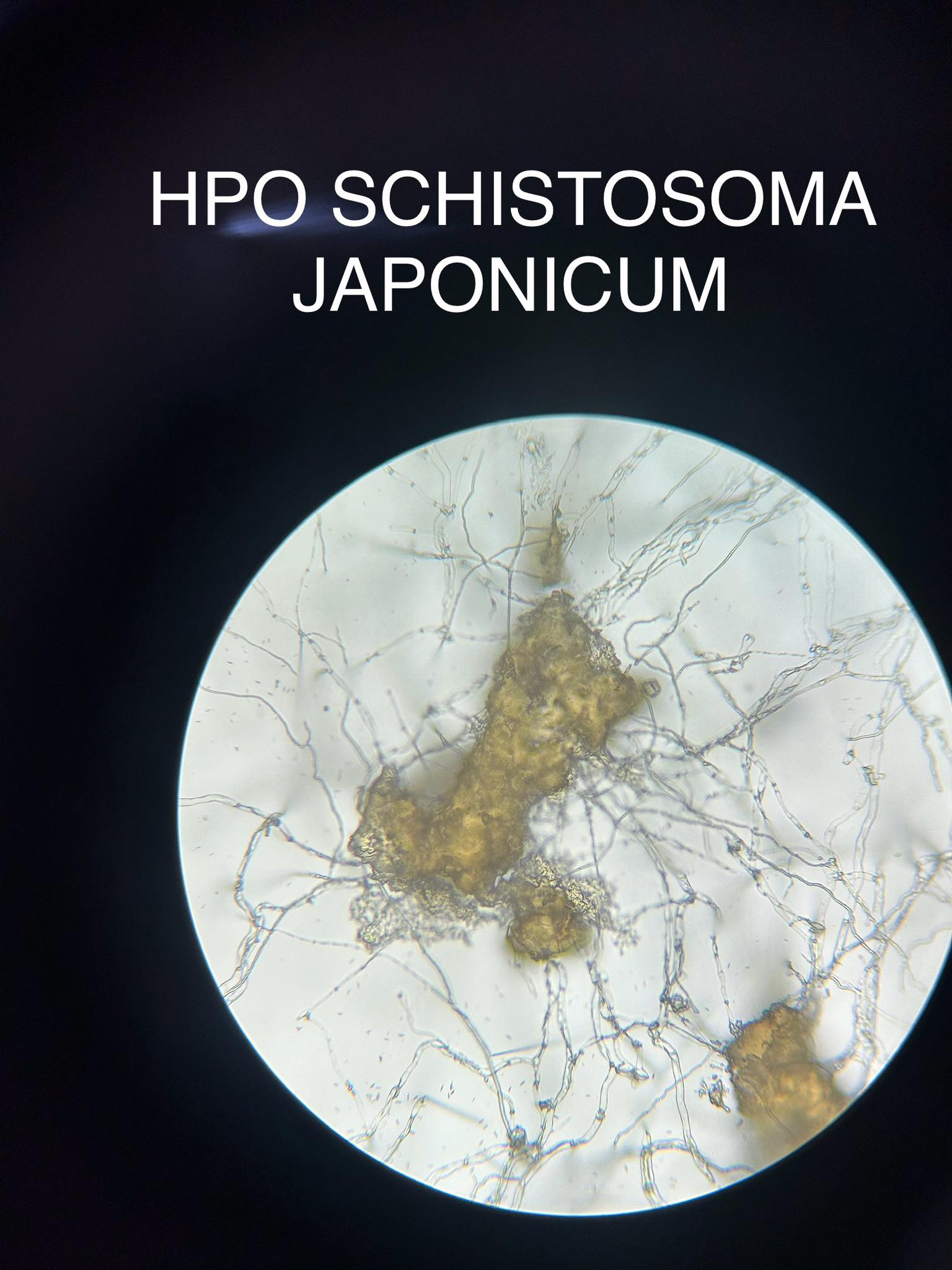 <p>Schistosoma japonicum</p>