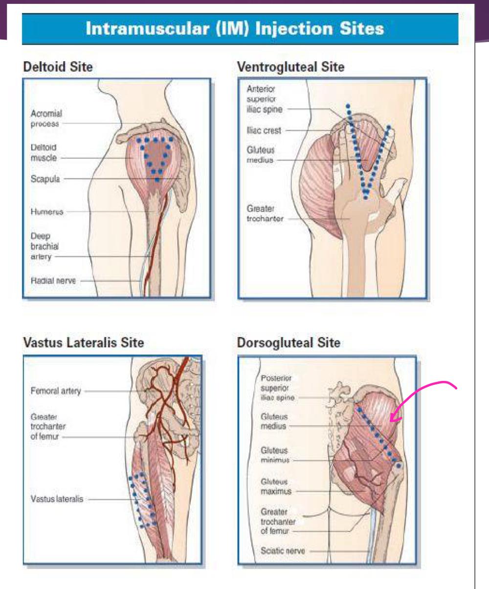 <ol><li><p>Dorsogluteal</p></li><li><p>Ventrogluteal</p></li><li><p>Rectus femoris</p></li><li><p>Vastus lateralis</p></li></ol>