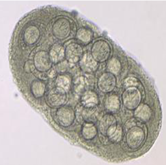 <ul><li><p><span>Eggs are 35-40 um</span></p></li><li><p><span>Found in packets usually containing 5-15 eggs</span></p><ul><li><p><span>Must see packets to diagnose by eggs alone because they look like Taenia eggs</span></p></li></ul></li><li><p><span>6 hooked oncosphere</span></p></li><li><p><span>Where the cucumber name comes from</span></p></li></ul><p></p>