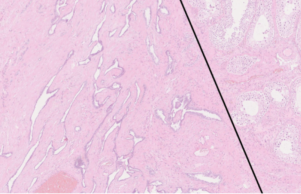 <p>Ett tubulärt system som fångar upp spermatozoa och leder de till efferenta dukterna → epididymis. </p><p>Epitelet är platt till kolumnärt och cilierat (till vänster om svarta sträcket). </p>