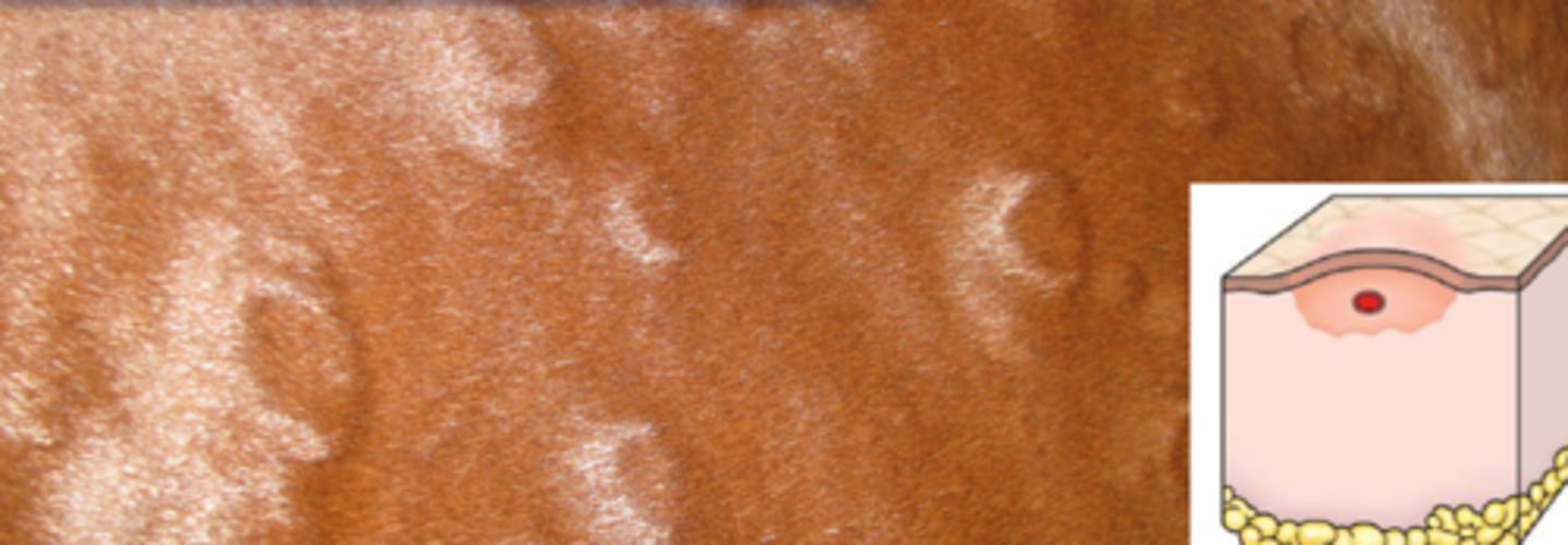 <p>What lesion is this? Is it primary or secondary?</p>