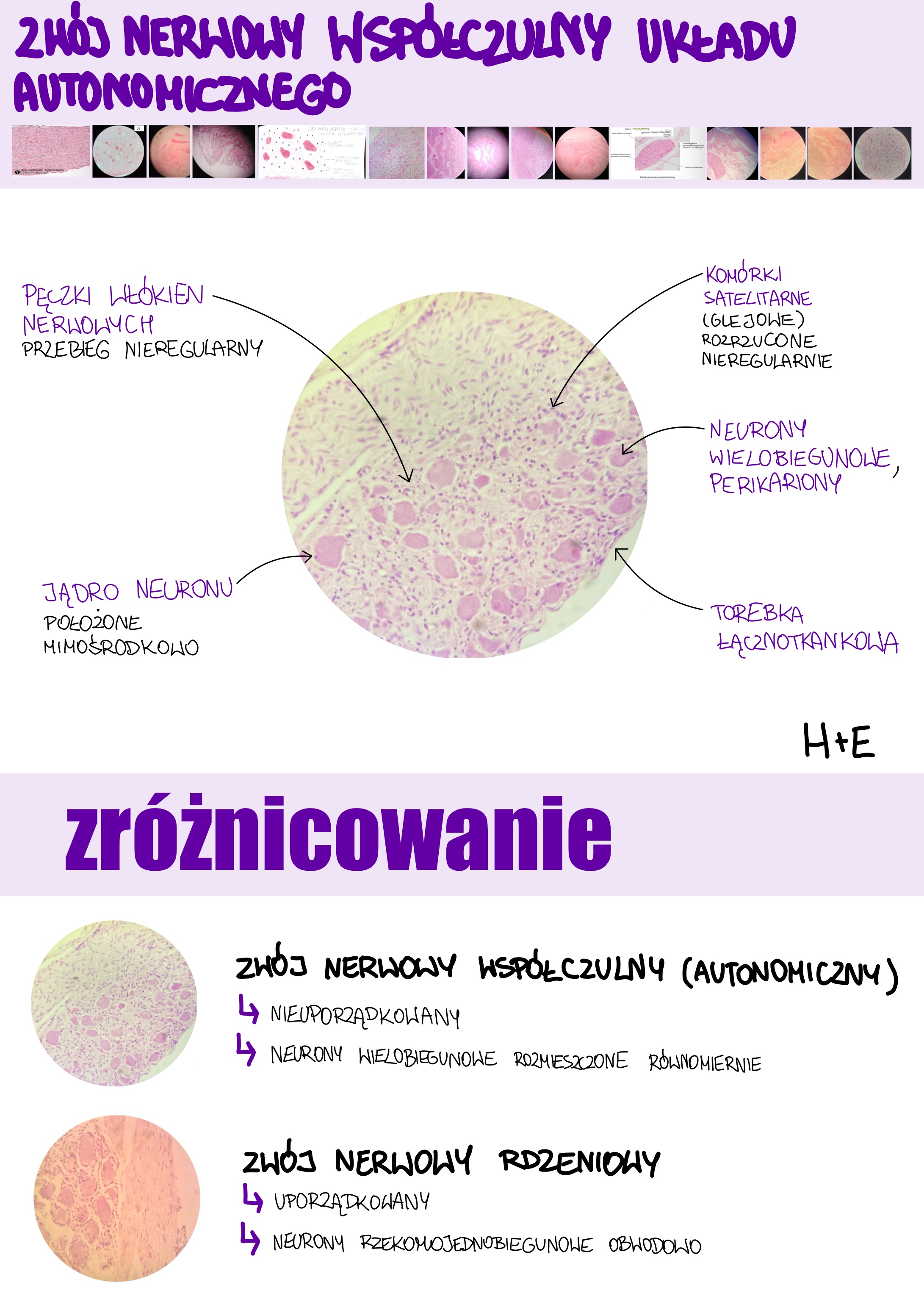 <p>Zwój nerwowy współczulny układu autonomicznego</p>
