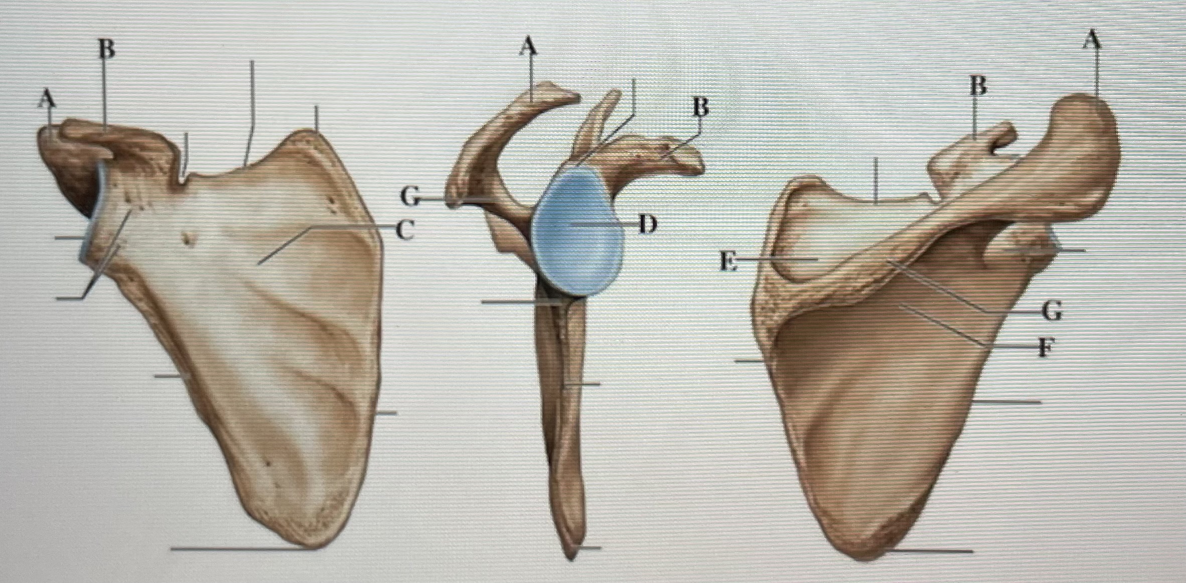 In the figure above,  *is the acromion and* _ is the suprapinous fossa 