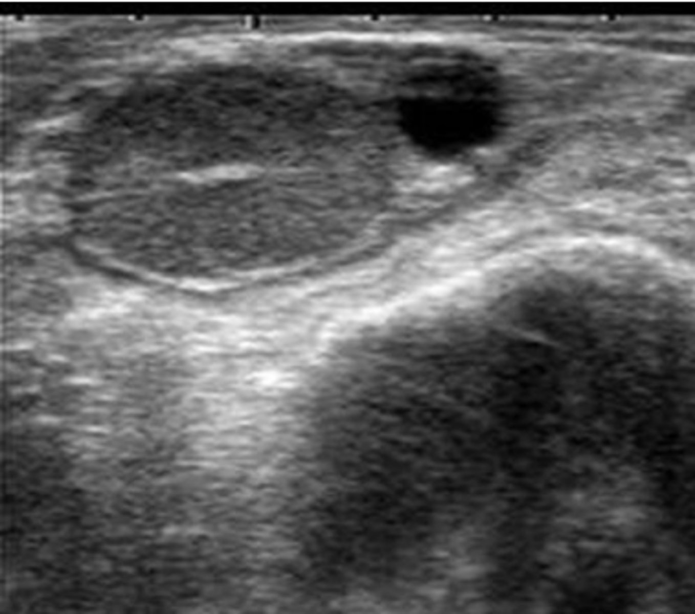 <p>What structures are present in the ovary shown in the picture?</p>