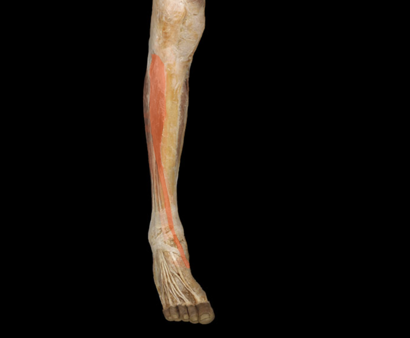term image