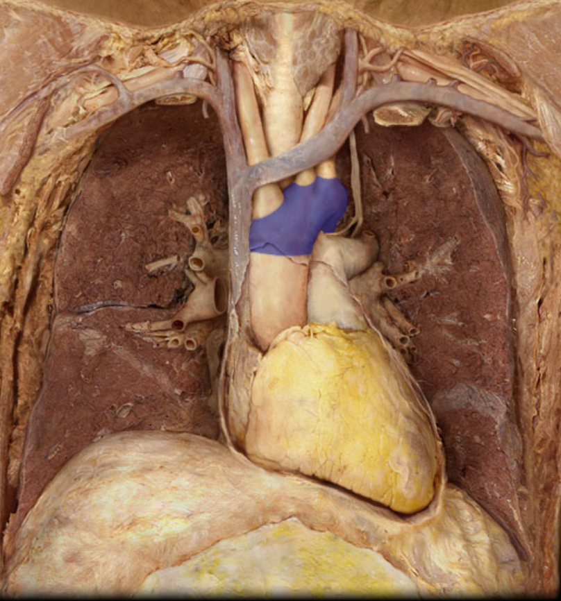 <p>Identify the structure</p>