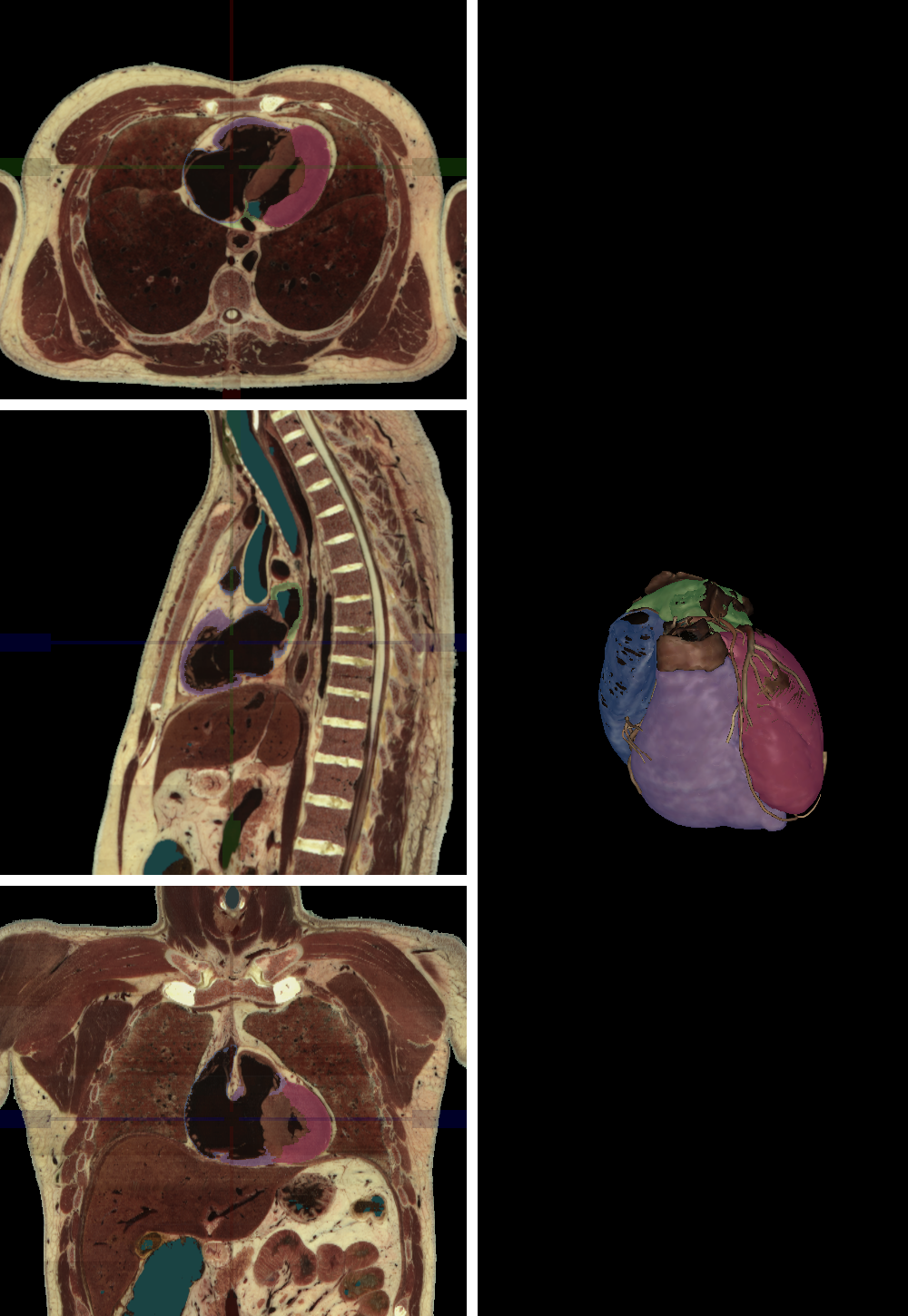 <p>Name the structure highlighted in blue </p>