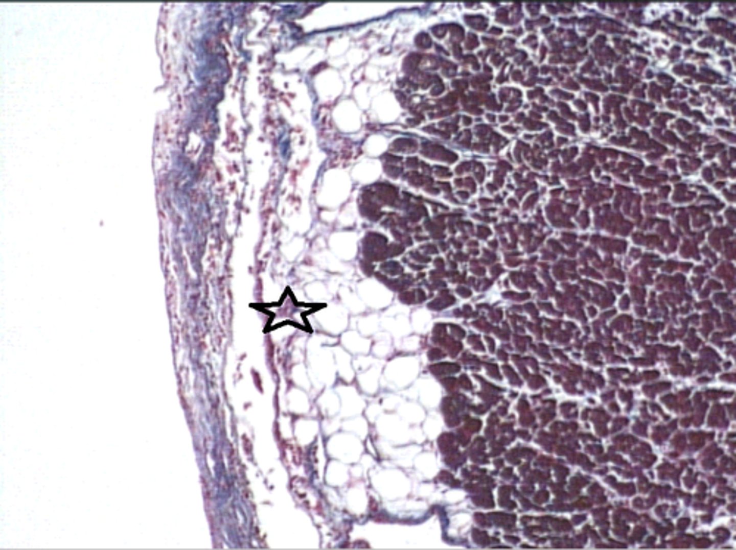 <p>The star is located in which of the following layers of the heart?</p>