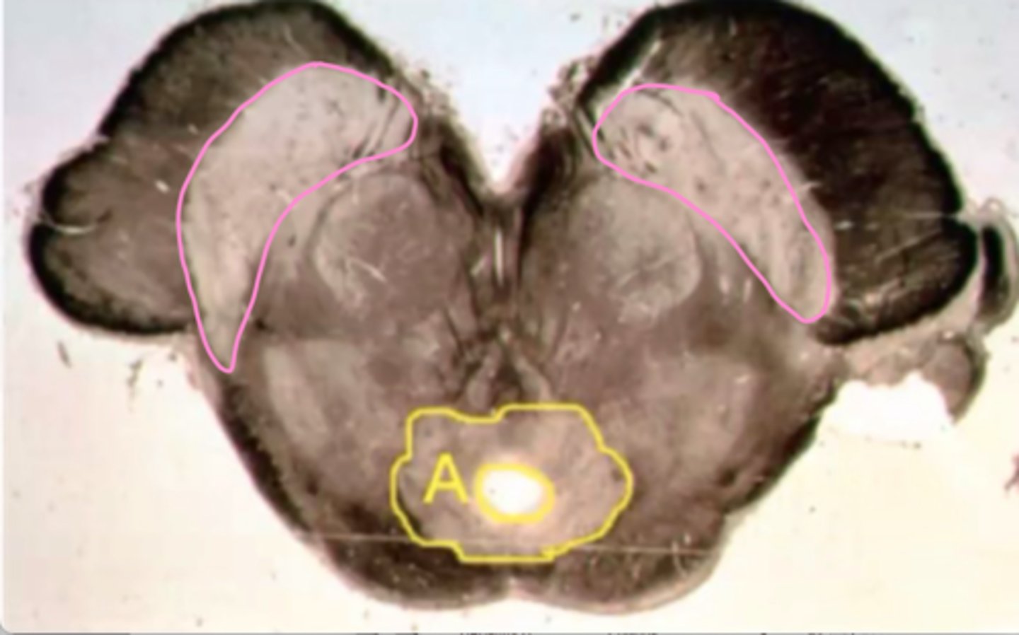 <p>Identify the structures indicated by the pink outline</p>