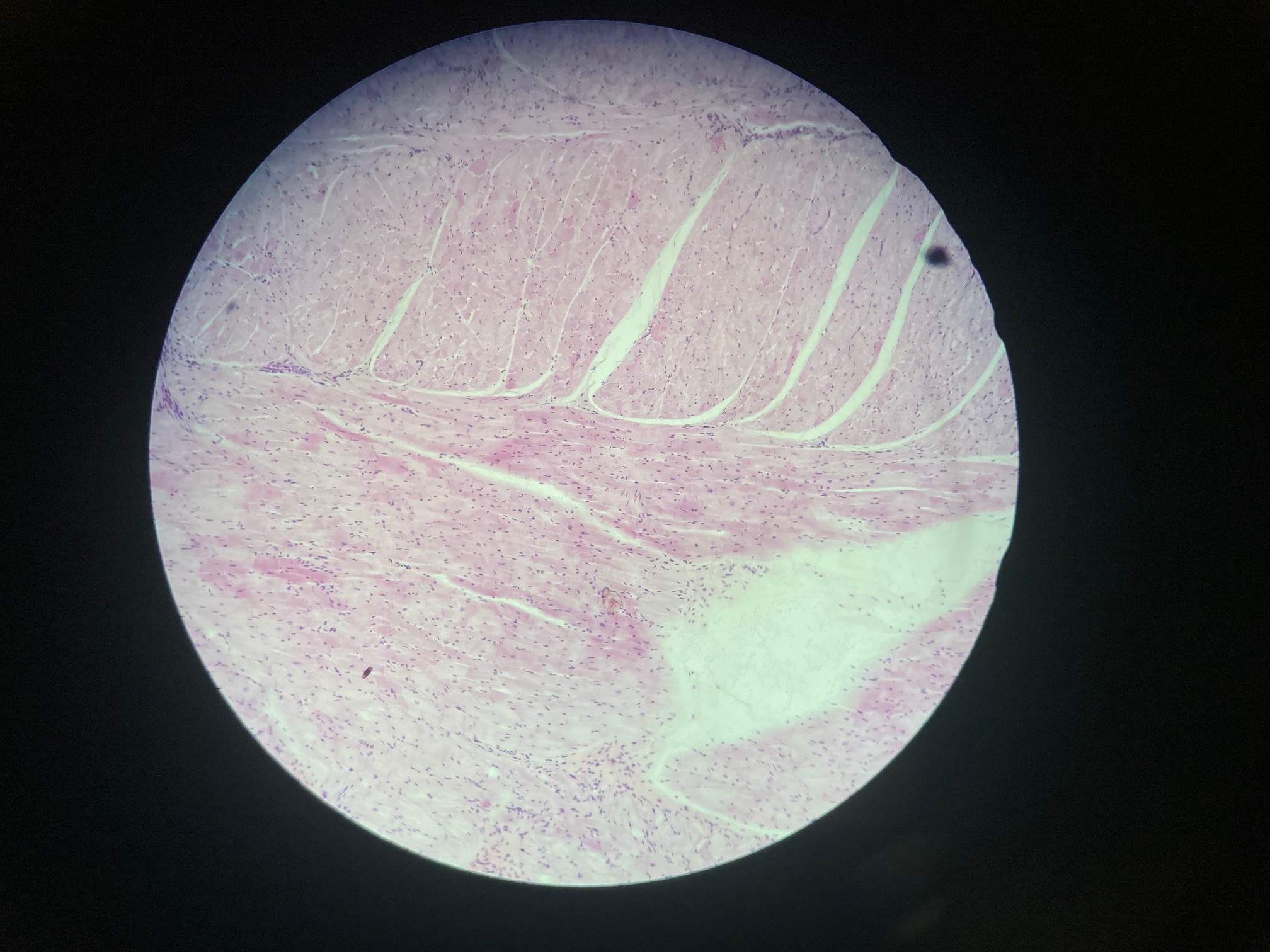 <p>Cardiac muscle (Purkinje fibers)</p><p>Purple rectangle</p><p>Elongated cells, fewer myofibrils than regular cardiac cells</p>