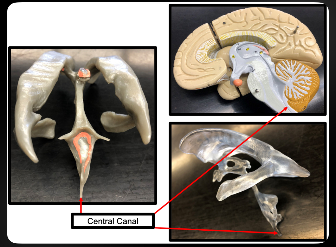 <p>Central Canal</p>