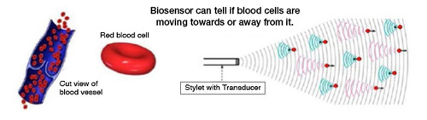 <p>The Ultrasound machine takes into account the fact that the Doppler Effect works twice due to the reflection off the moving blood as it calculates the speed at which the blood is flowing.</p>