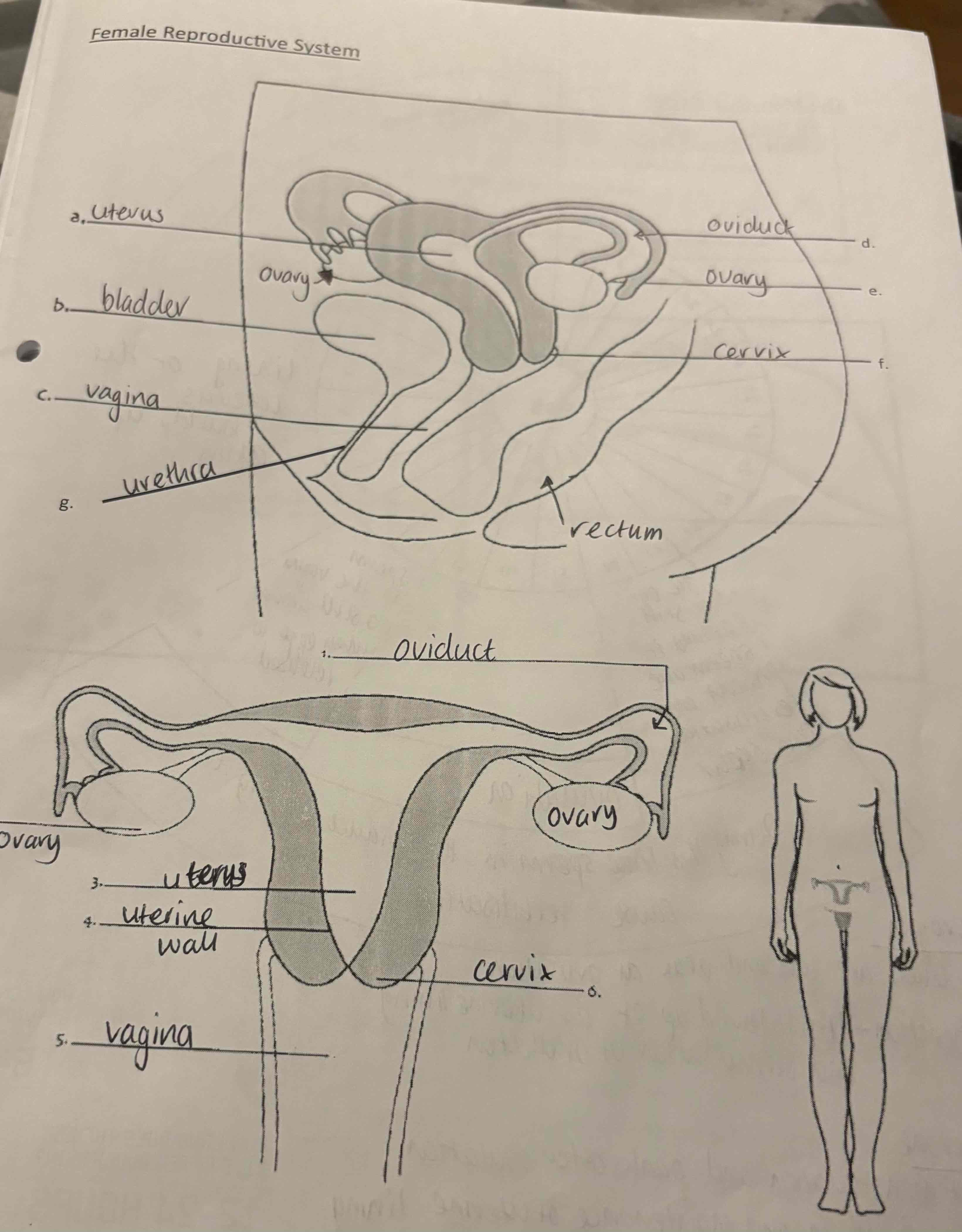 <p>Look at this label of the female reproductive system: </p>