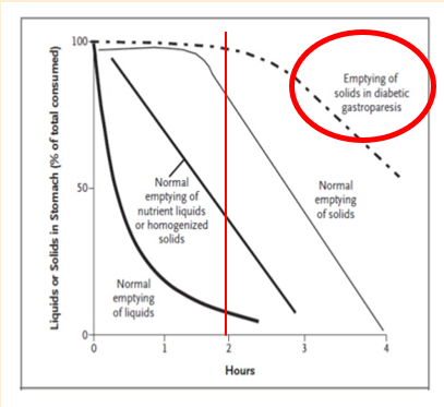 <p><span><strong><u><span>Possible pathologies:</span></u></strong></span></p><p><span><span>•Delayed filling</span></span></p><p><span><span>•Evidence of Reflux</span></span></p><p><span><span>•Delayed emptying</span></span></p><p></p>